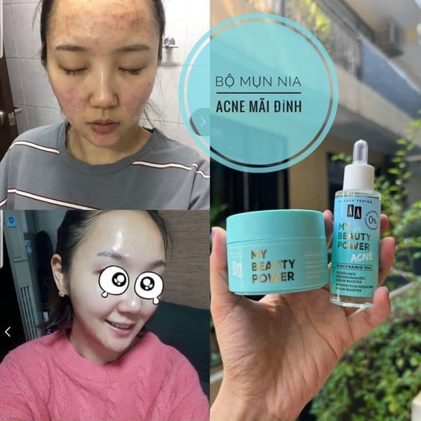 Serum giảm mụn, phục hồi da AA COSMETICS My Beauty Power Acne Niacinamide 10% - Thumbnail 5